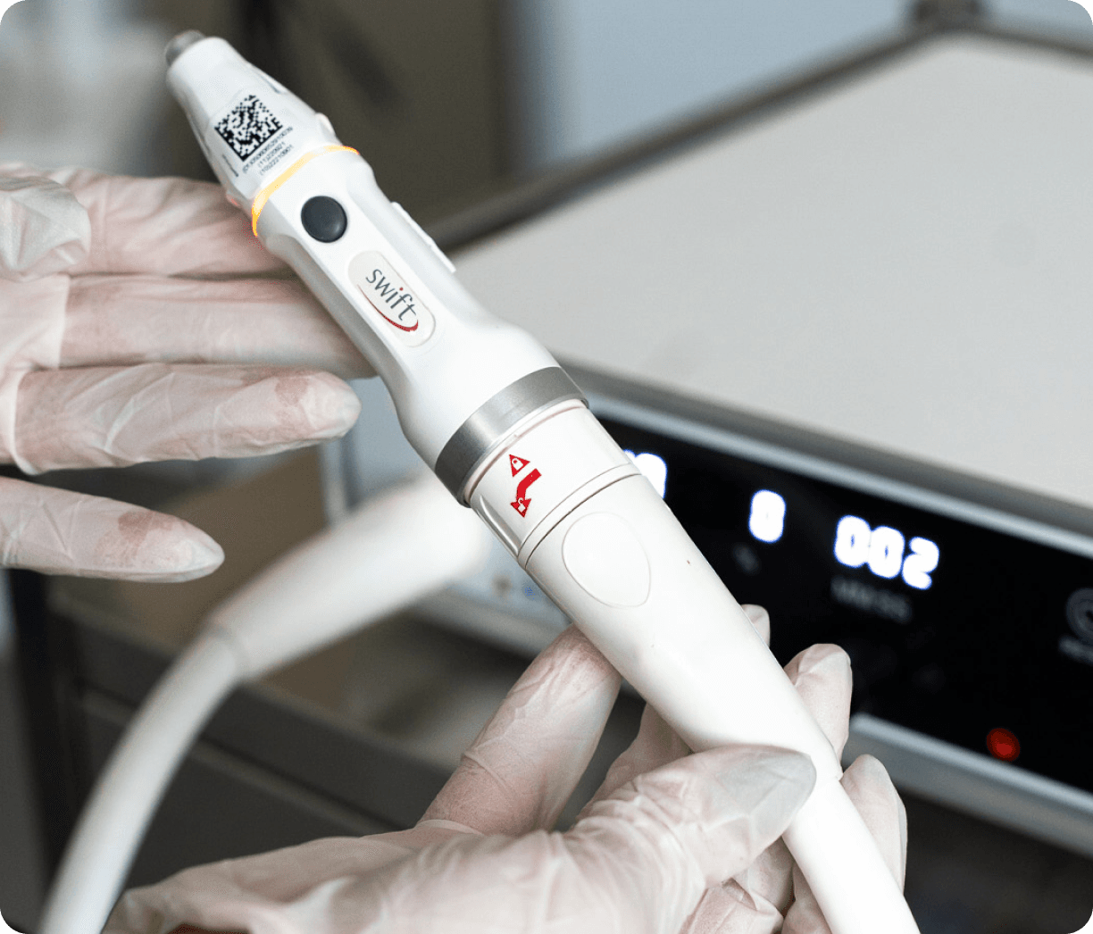 SWIFT microwave therapy handpiece used to treat verrucas