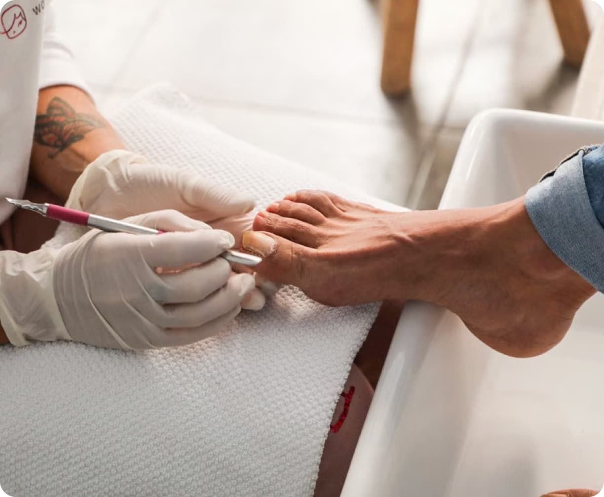 Gloved podiatrist filing a patient's toenail