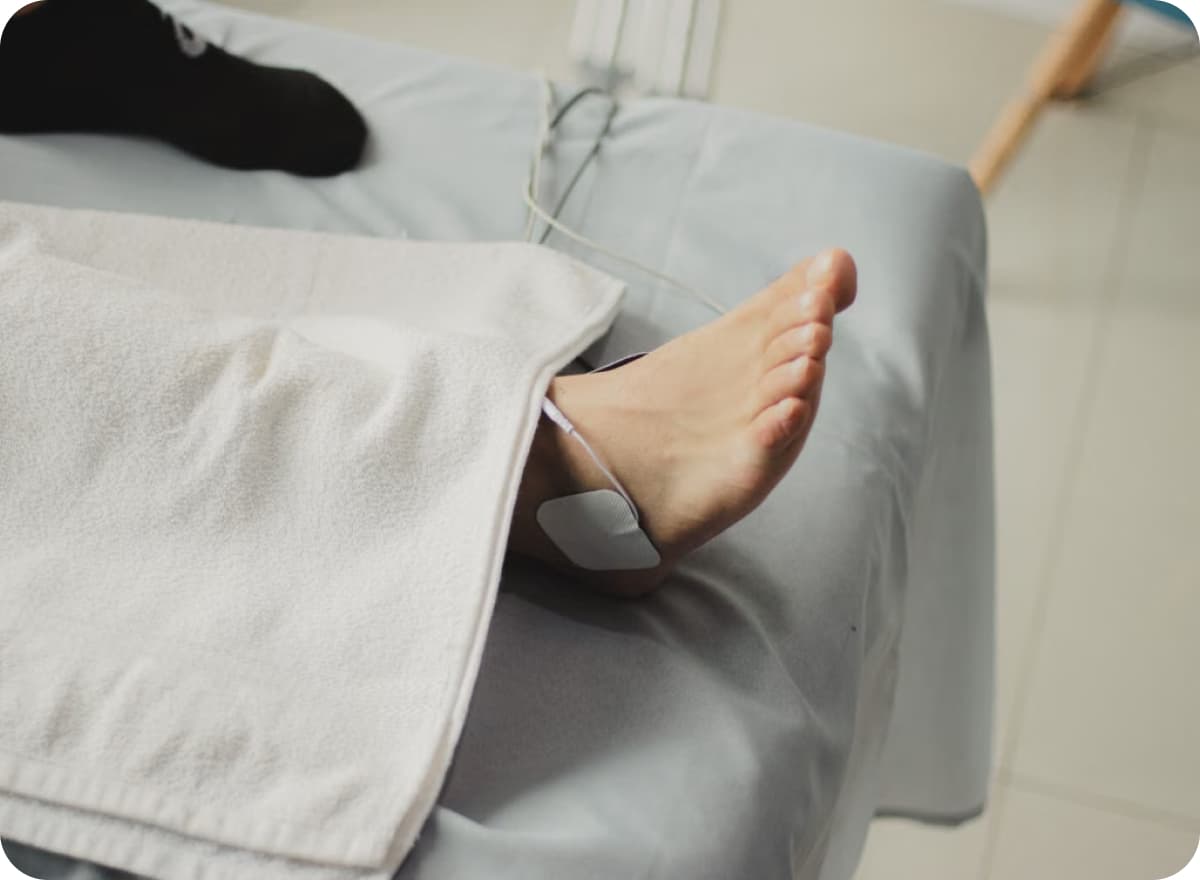 Patient's foot resting on a treatment table under a towel